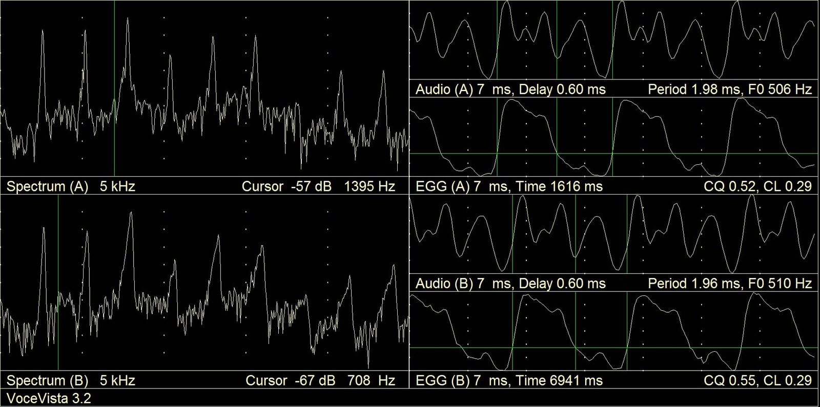 Power spectra with the indicated regions of formants 1 and 2, and EGG signal curves with a pronounced knee shape