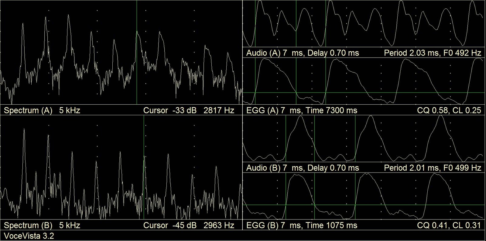 Comparison of EGG curve shape and sound pressure level between countertenor falsetto below and voce faringea above on B4