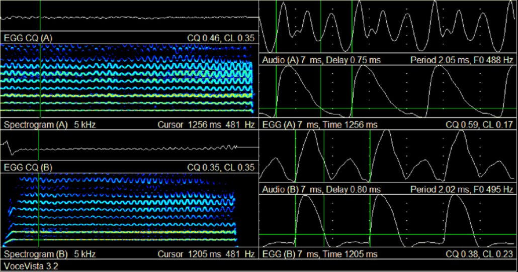 Spectrogram, audio signal and EGG signal of the voce faringea in the upper row and of the falsetto in the lower row, sung on B4