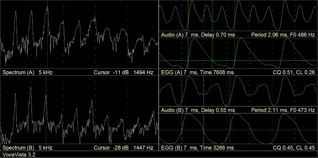 Power spectrum and EGG of a sung tone on B flat 4 in voce faringea above and in mezza voce below